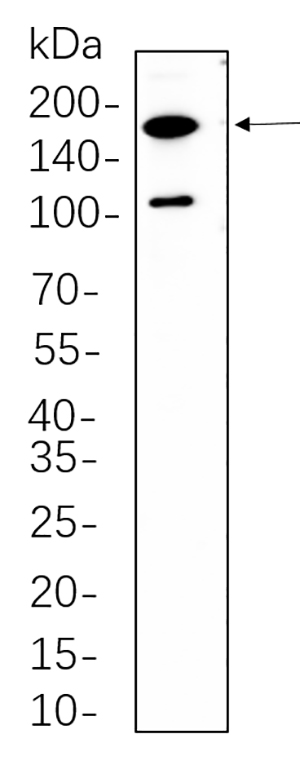 Rictor兔单抗,Rictor Rabbit Monoclonal antibody