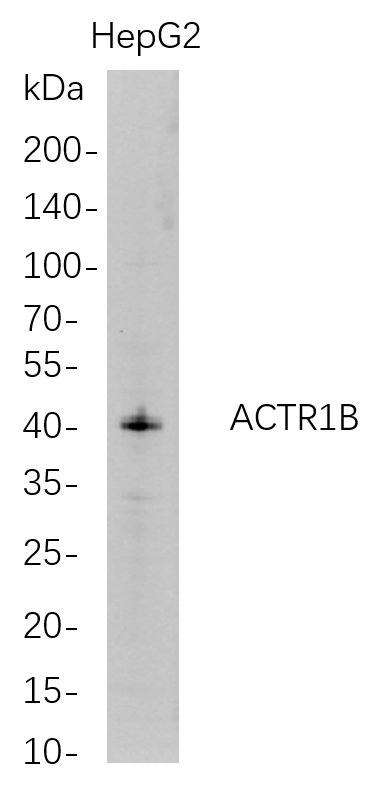 ACTR1B兔单抗,ACTR1B Rabbit Monoclonal antibody