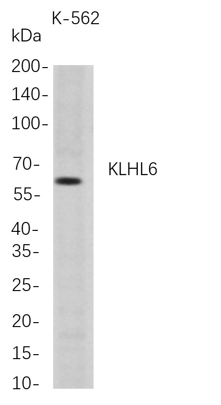 KLHL6兔单抗,KLHL6 Rabbit Monoclonal antibody