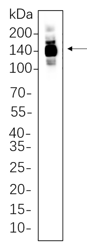 HDAC4兔单抗,HDAC4 Rabbit Monoclonal antibody