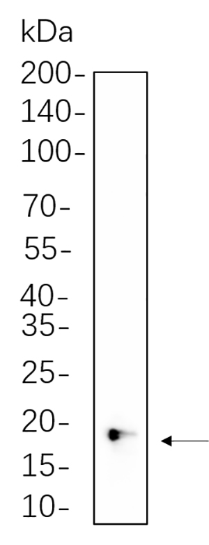4E-BP1兔单抗,4E-BP1 Rabbit Monoclonal antibody
