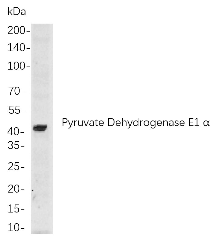 Pyruvate Dehydrogenase E1 α兔单抗,Pyruvate Dehydrogenase E1 α Rabbit Monoclonal antibody