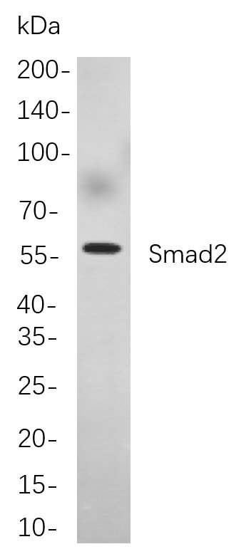 Smad2兔单抗,Smad2 Rabbit Monoclonal antibody