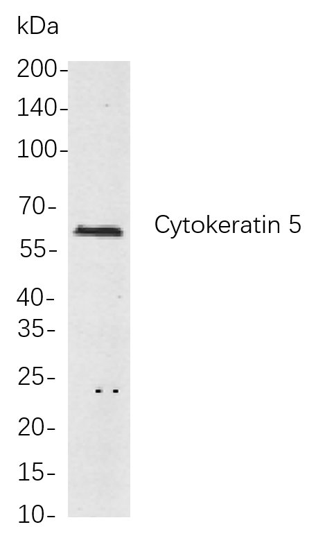 Cytokeratin 5兔单抗,Cytokeratin 5 Rabbit Monoclonal antibody