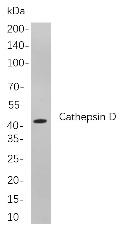 Cathepsin D兔单抗,Cathepsin D Rabbit Monoclonal antibody