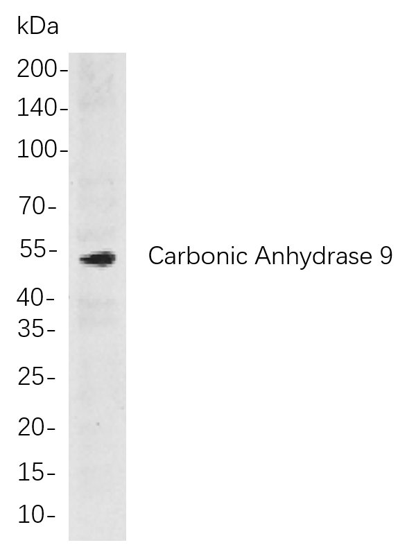 Carbonic Anhydrase 9兔单抗,Carbonic Anhydrase 9 Rabbit Monoclonal antibody