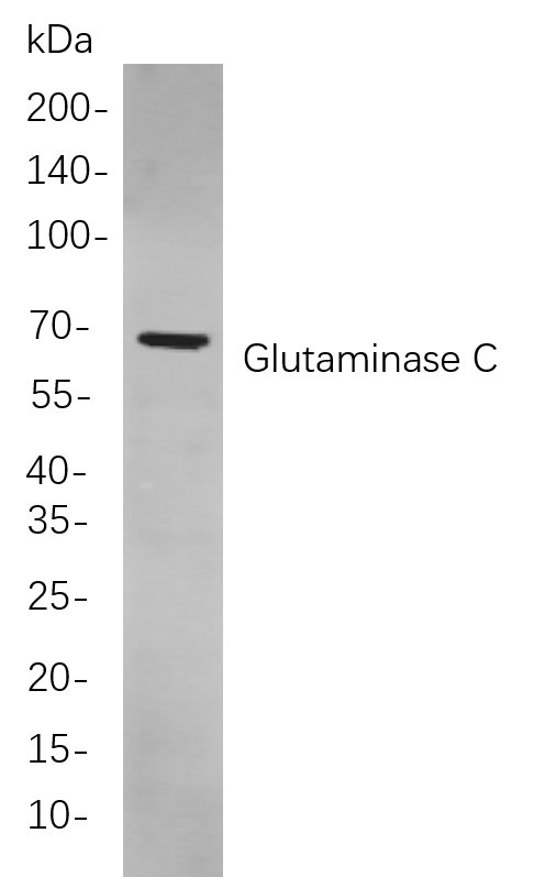 Glutaminase C兔单抗,Glutaminase C Rabbit Monoclonal antibody