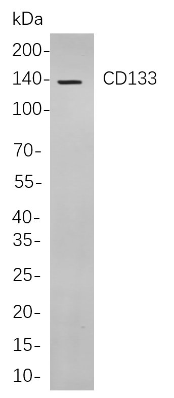 CD133兔单抗,CD133 Rabbit Monoclonal antibody