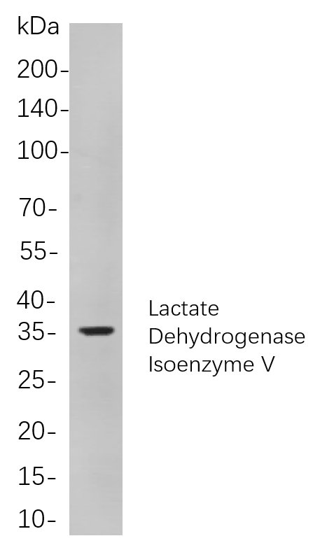 Lactate Dehydrogenase Isoenzyme V兔单抗,Lactate Dehydrogenase Isoenzyme V Rabbit Monoclonal antibody