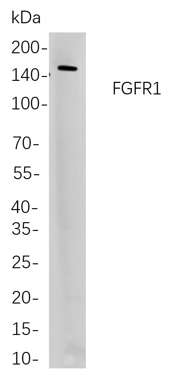FGFR1兔单抗,FGFR1 Rabbit Monoclonal antibody