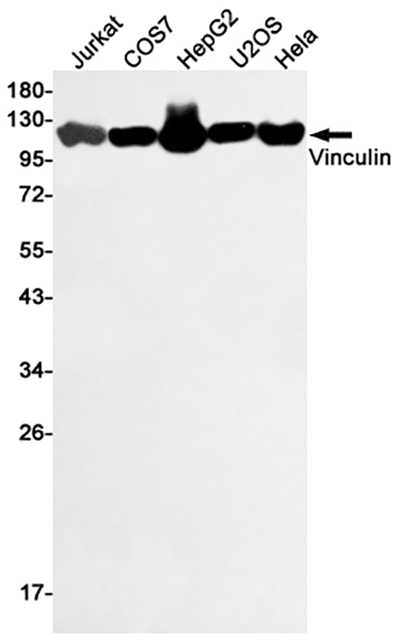 Vinculin兔多抗,Vinculin Rabbit Polyclonal Antibody