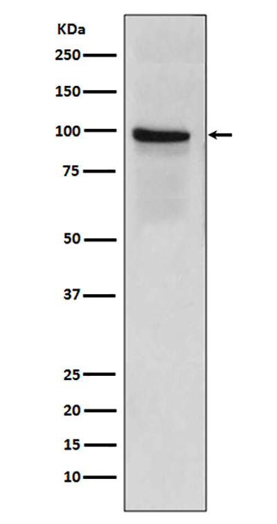 Thrombomodulin兔多抗,Thrombomodulin Rabbit Polyclonal Antibody