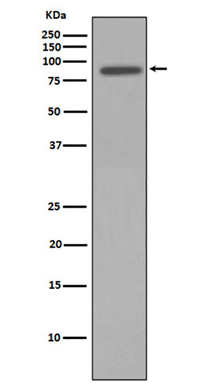 Nibrin兔多抗,Nibrin Rabbit Polyclonal Antibody