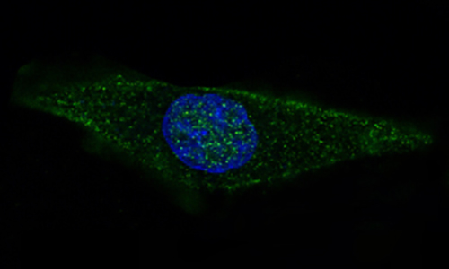 GFAP兔多抗,GFAP Rabbit Polyclonal Antibody