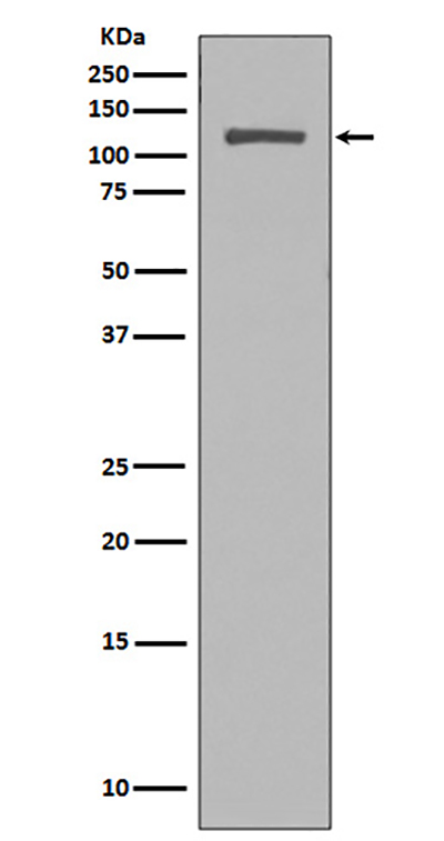 NUP98兔多抗,NUP98 Rabbit Polyclonal Antibody