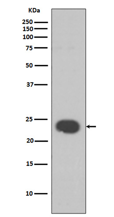 HP1 alpha兔多抗,HP1 alpha Rabbit Polyclonal Antibody