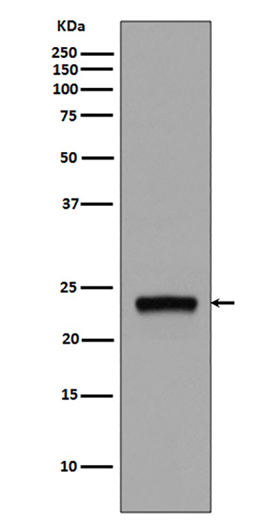Rab5兔多抗,Rab5 Rabbit Polyclonal Antibody
