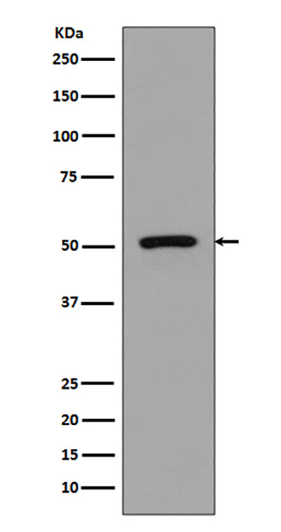 FLI1兔多抗,FLI1 Rabbit Polyclonal Antibody