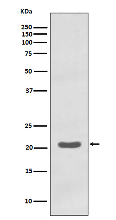MTCO2兔多抗,MTCO2 Rabbit Polyclonal Antibody