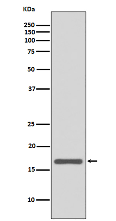 Anterior Gradient 2兔多抗,Anterior Gradient 2 Rabbit Polyclonal Antibody