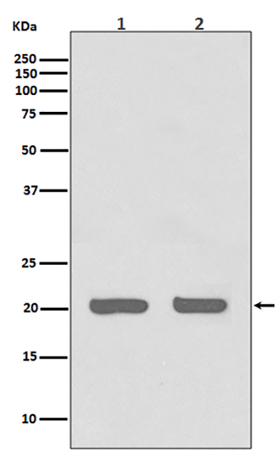 IL-1 Receptor Antagonist Protein兔多抗,IL-1 Receptor Antagonist Protein Rabbit Polyclonal Antibody