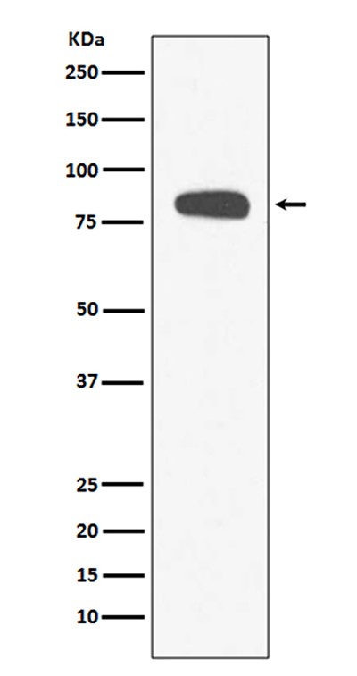 Stromal Interaction Molecule 1兔多抗,Stromal Interaction Molecule 1 Rabbit Polyclonal Antibody