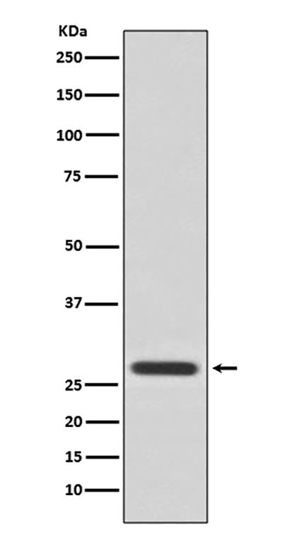 14-3-3 theta兔多抗,14-3-3 theta Rabbit Polyclonal Antibody