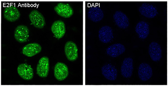 E2F1兔多抗,E2F1 Rabbit Polyclonal Antibody