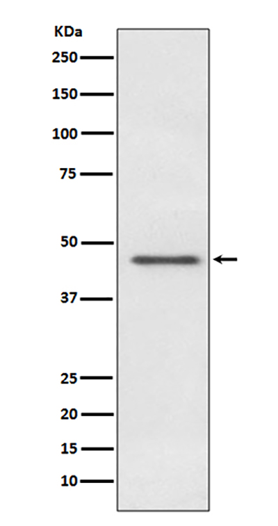 Pyruvate Dehydrogenase E1 alpha兔多抗,Pyruvate Dehydrogenase E1 alpha Rabbit Polyclonal Antibody