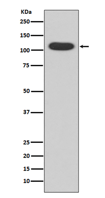 Aryl Hydrocarbon Receptor兔多抗,Aryl Hydrocarbon Receptor Rabbit Polyclonal Antibody