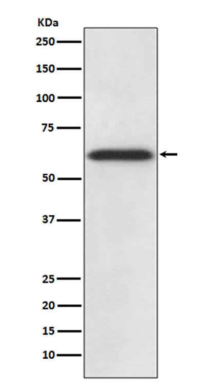 Catalase兔多抗,Catalase Rabbit Polyclonal Antibody