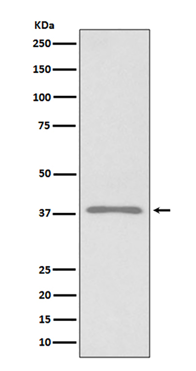 Podoplanin兔多抗,Podoplanin Rabbit Polyclonal Antibody