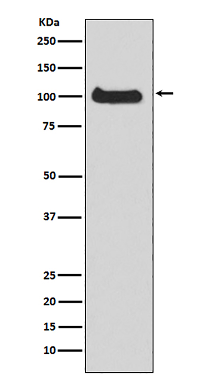 PKD1兔多抗,PKD1 Rabbit Polyclonal Antibody