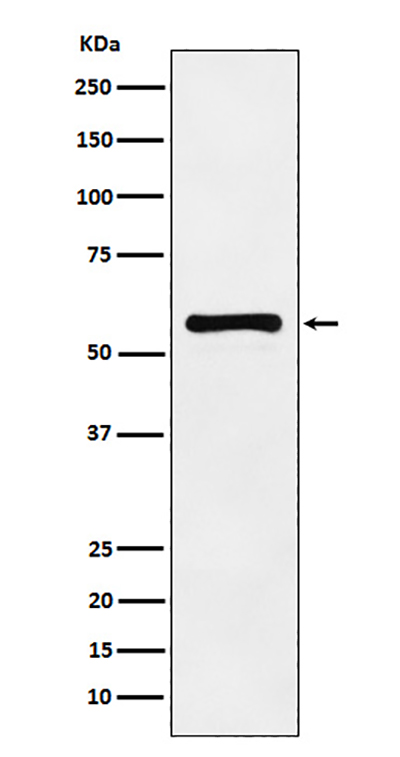 PAK2兔多抗,PAK2 Rabbit Polyclonal Antibody
