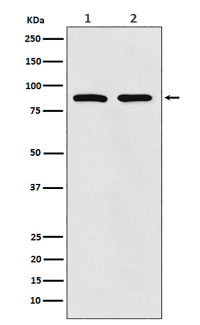 Thrombopoietin Receptor兔多抗,Thrombopoietin Receptor Rabbit Polyclonal Antibody