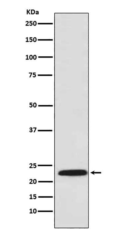 Proteasome beta 8兔多抗,Proteasome beta 8 Rabbit Polyclonal Antibody