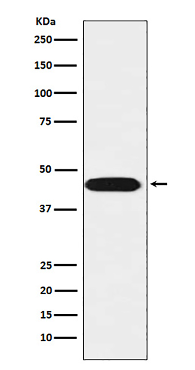 LIS1兔多抗,LIS1 Rabbit Polyclonal Antibody
