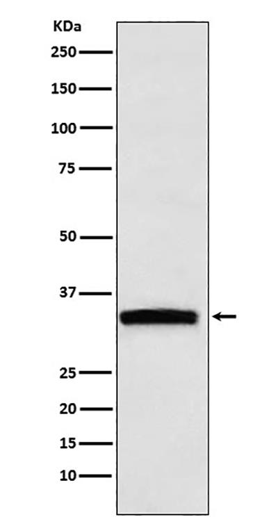 GDF15兔多抗,GDF15 Rabbit Polyclonal Antibody