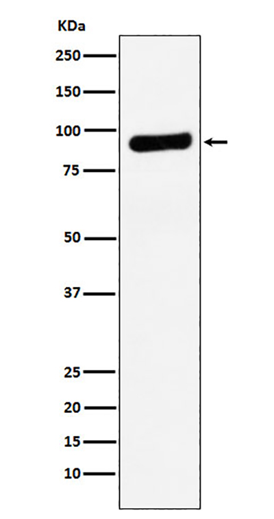 RRM1兔多抗,RRM1 Rabbit Polyclonal Antibody