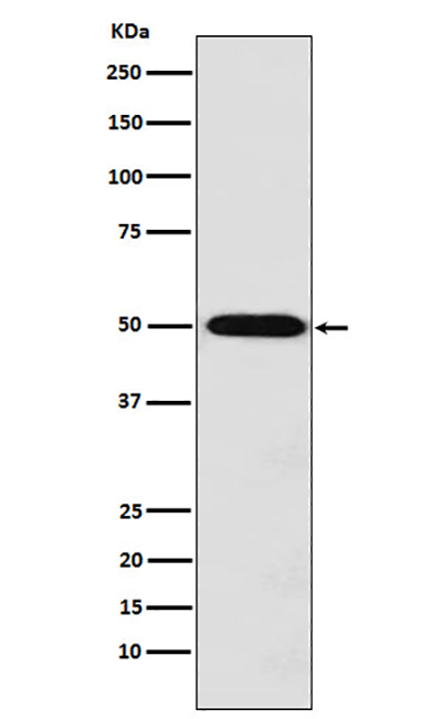 Monocarboxylic Acid Transporter 1兔多抗,Monocarboxylic Acid Transporter 1 Rabbit Polyclonal Antibody