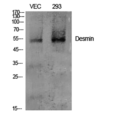 Desmin兔多抗,Desmin Rabbit Polyclonal Antibody