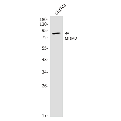 MDM2兔多抗,MDM2 Rabbit Polyclonal Antibody