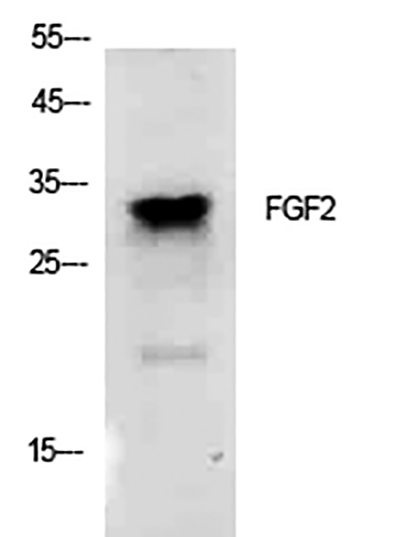 FGF2兔多抗,FGF2 Rabbit Polyclonal Antibody