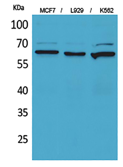CD73兔多抗,CD73 Rabbit Polyclonal Antibody