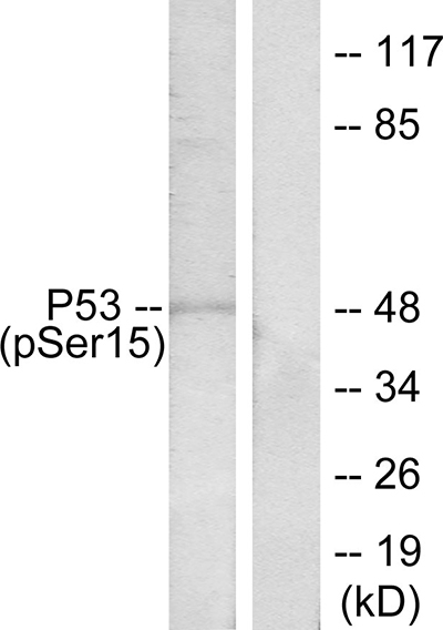 Phospho-p53 (Ser15)兔多抗,Phospho-p53 (Ser15) Rabbit Polyclonal Antibody