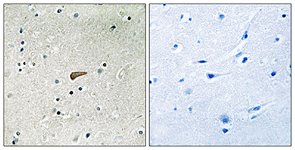 Phospho-FRS2 (Tyr436)兔多抗,Phospho-FRS2 (Tyr436) Rabbit Polyclonal Antibody