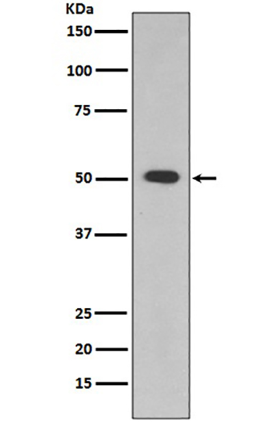 ALDH1A1兔多抗,ALDH1A1 Rabbit Polyclonal Antibody