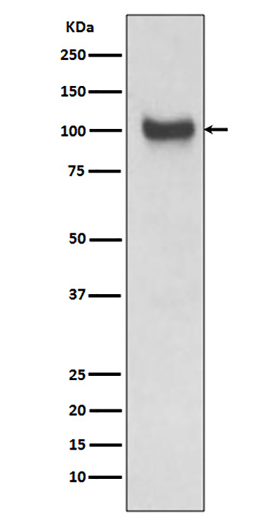VCAM1兔多抗,VCAM1 Rabbit Polyclonal Antibody