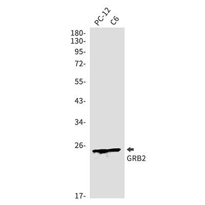 GRB2兔多抗,GRB2 Rabbit Polyclonal Antibody