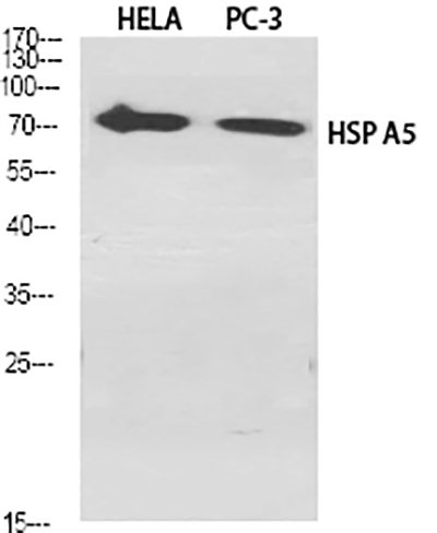 GRP78 BiP兔多抗,GRP78 BiP Rabbit Polyclonal Antibody